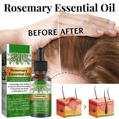 Rosemary Essential Oil For Hair Growth